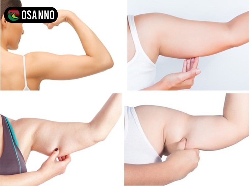 Cách thực hiện massage bắp tay ngay tại nhà