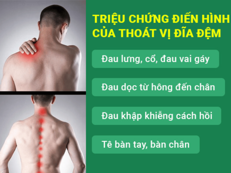 Biểu hiện tê bì, đau nhức lan từ lưng xuống chân hoặc cổ và tay.