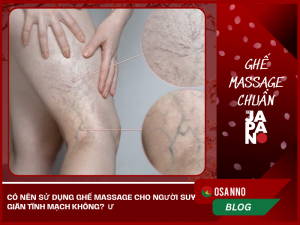 Suy giãn tĩnh mạch