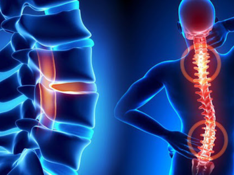 Cấu trúc cột sống suy yếu theo thời gian, gây đau nhức và hạn chế vận động.