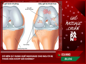 Thoái hóa khớp gối